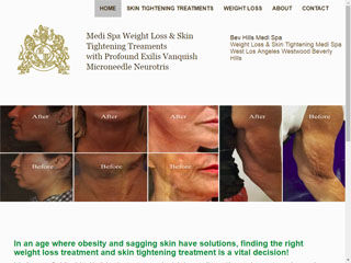 Website Design / Development & SEO Skin Tightening & Weight Loss Los Angeles